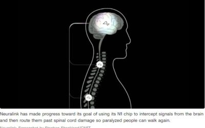 Neuralink’s Brain Chip Plan: Help the Blind See and the Paralyzed Walk